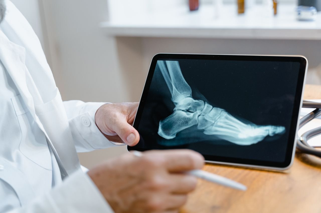 Mastering the First Impression: Your intriguing post title goes here Doctor examining a foot X-ray image on a digital tablet using a stylus in a medical office.